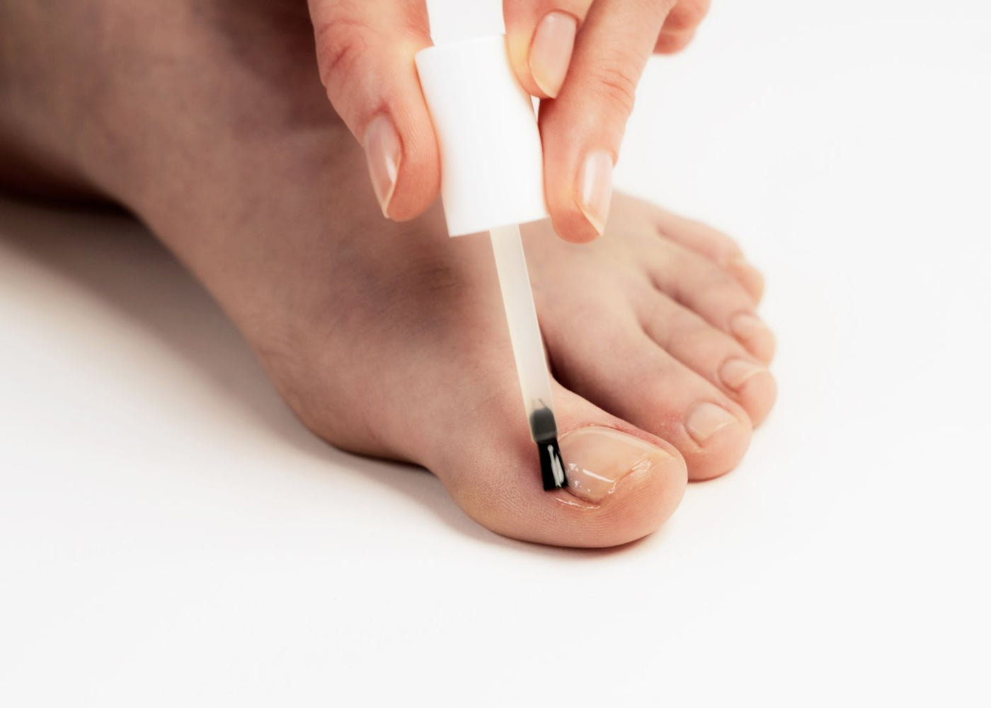 Traumatisme de l’ongle : causes, soins et traitements