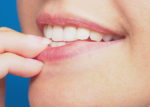 Abgekauten Nägeln: Welcher Nagellack ist der richtige?