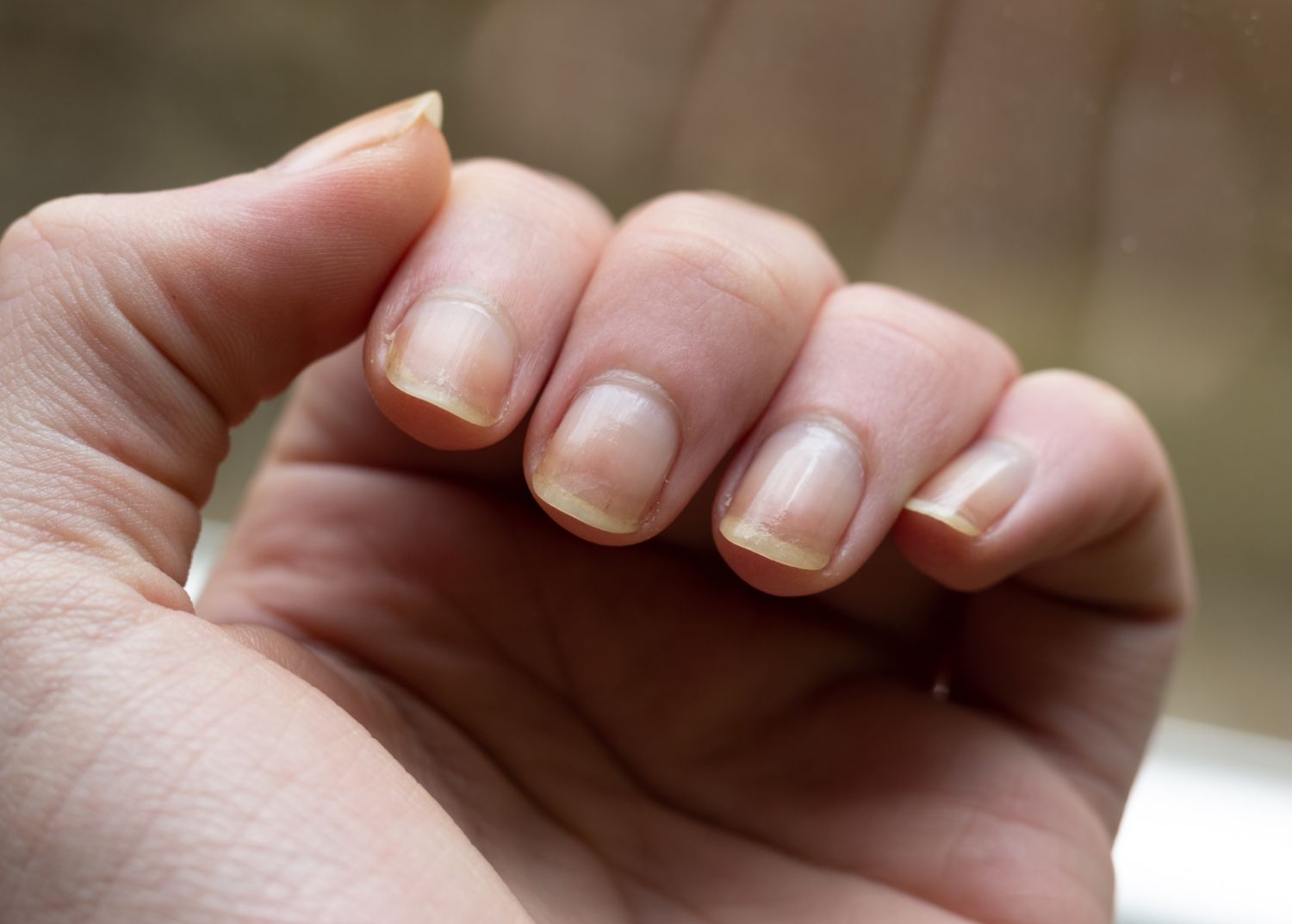 Gros plan sur le bout des doigts jauni d’une main