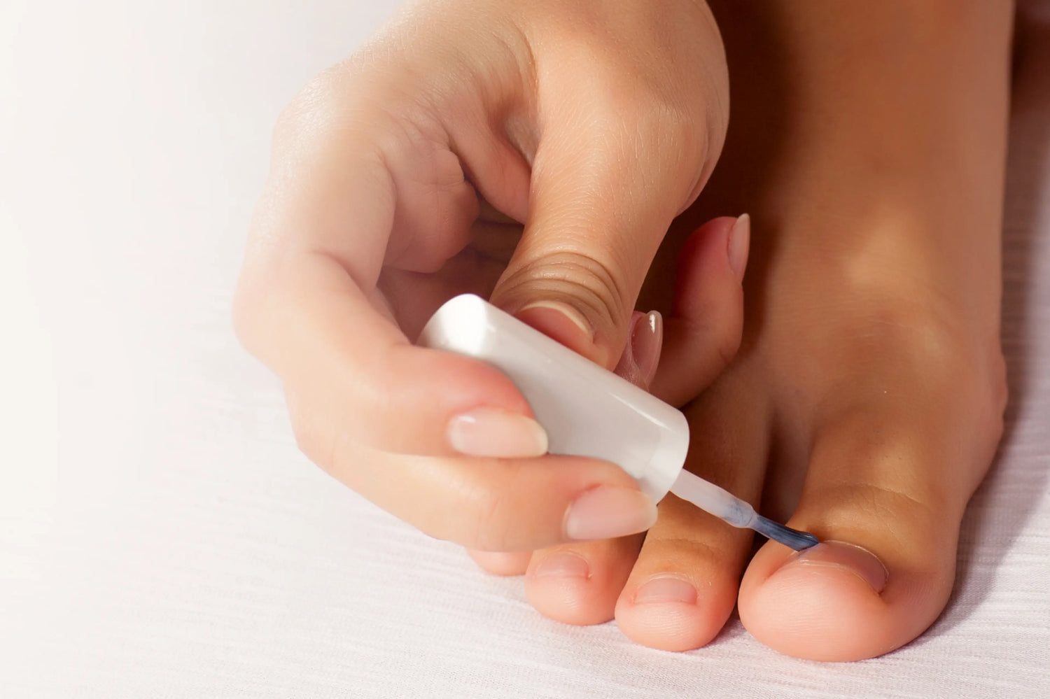 Pédicure-podologue traitant un ongle du gros orteil incarné