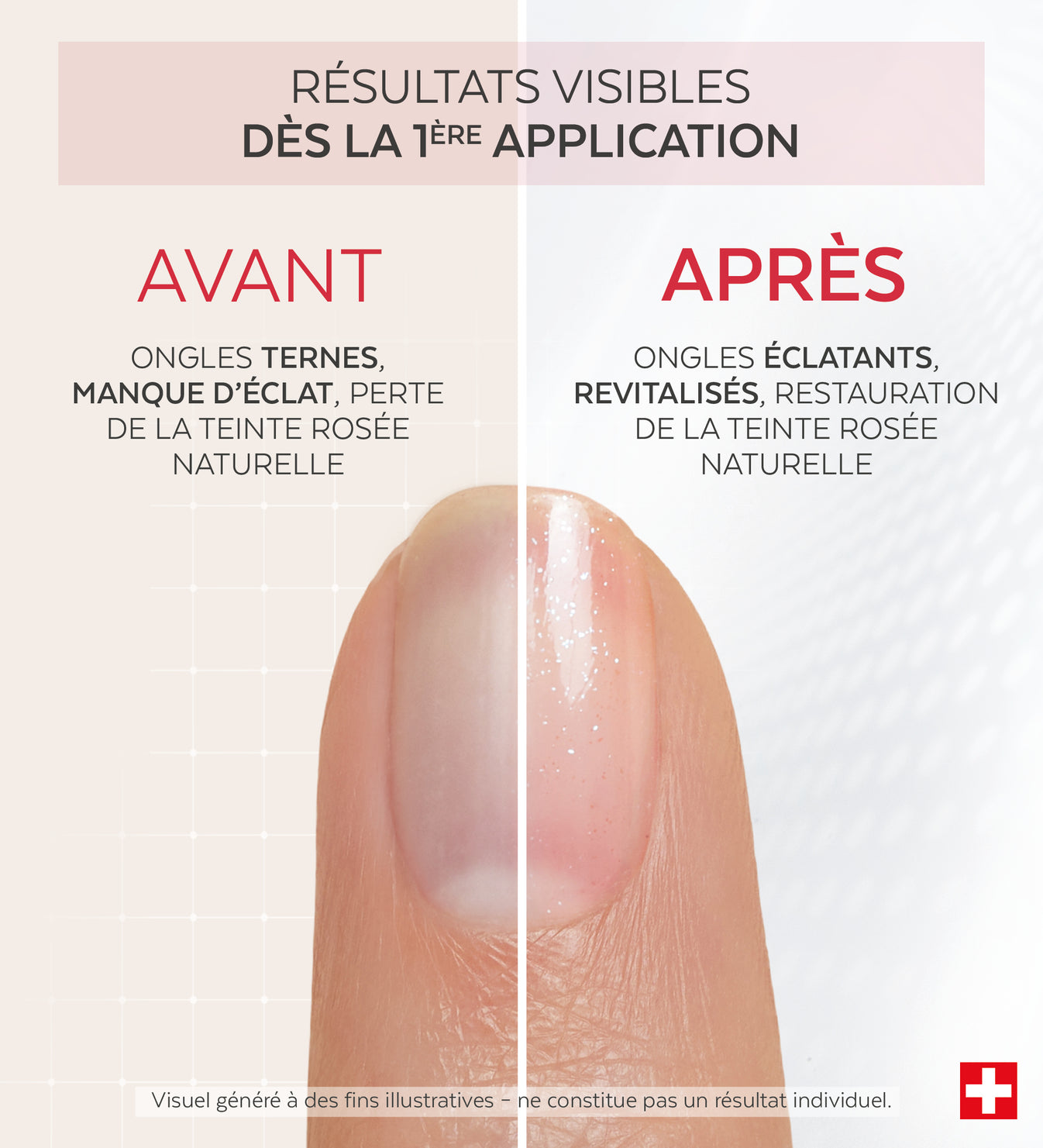 Résultats avant après du vernis Nail Corrector booster éclat biopeptides Poderm dès la 1ère application