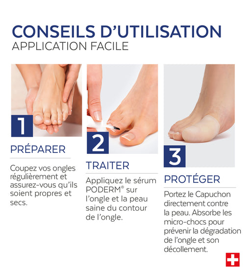 Duo Ongles Traumatisés Sport