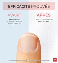 Efficacité prouvée avant après du sérum concentré collagène Poderm