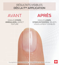 Résultats avant après du vernis Nail Corrector comblant collagène Poderm dès la 1ère application