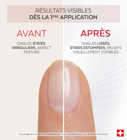Résultats avant après du vernis Nail Corrector comblant collagène Poderm dès la 1ère application