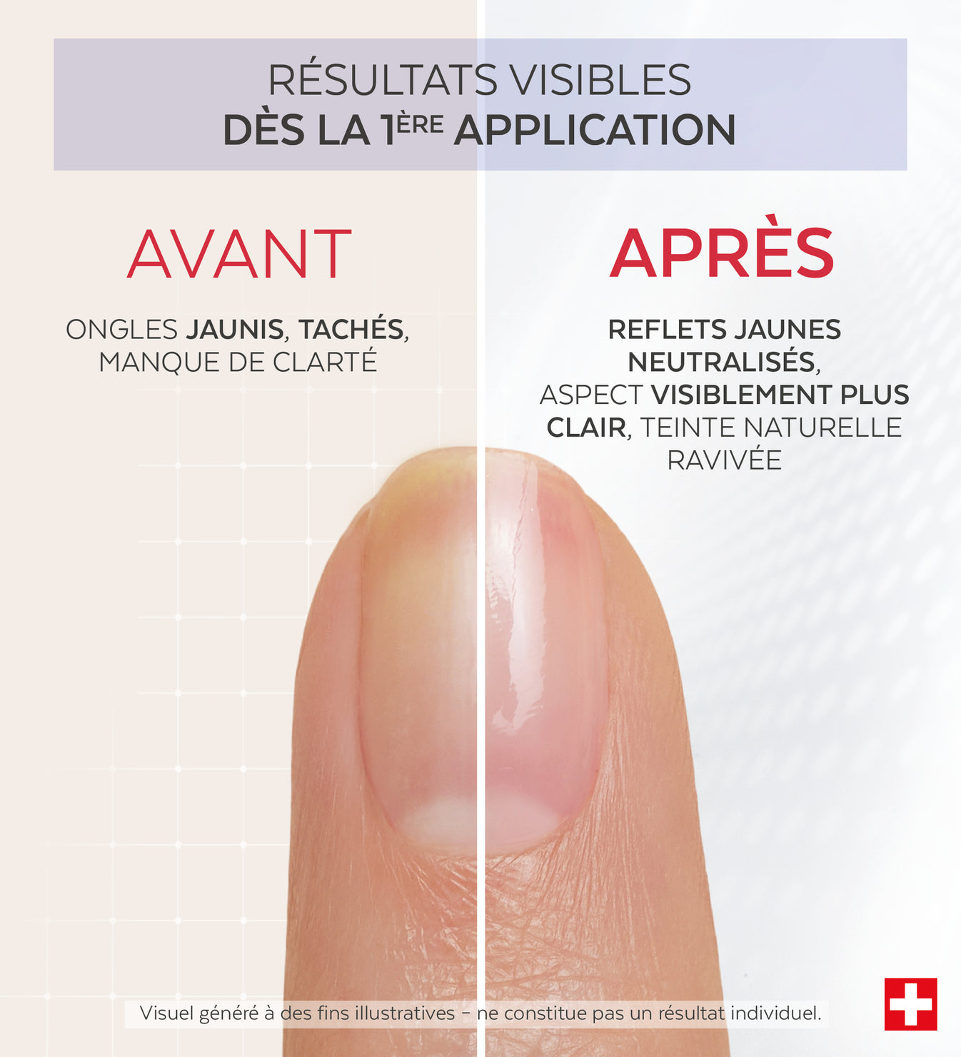Résultats avant après du vernis Nail Corrector déjaunissant citron Poderm dès la 1ère application