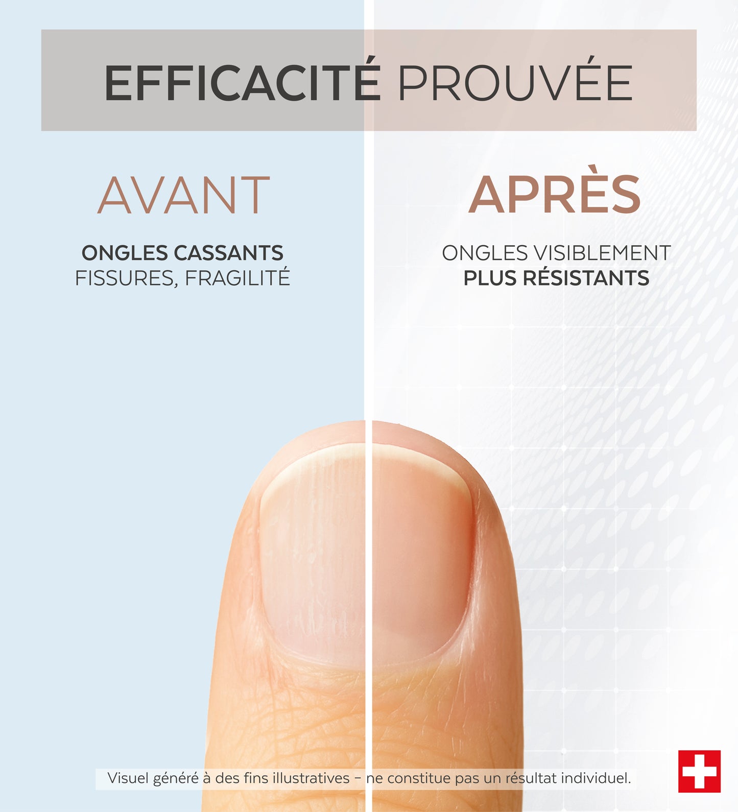 Efficacité prouvée avant après du sérum concentré kératine Poderm
