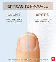 Efficacité prouvée avant après du sérum concentré kératine Poderm