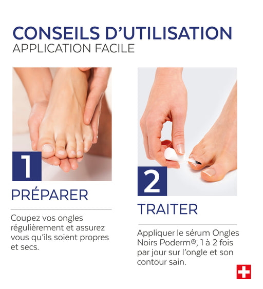 Sérum Ongles noirs, traumatisés