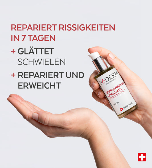 Hautrisse und Hornhaut Plege