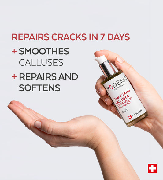 Cracks and calluses Care