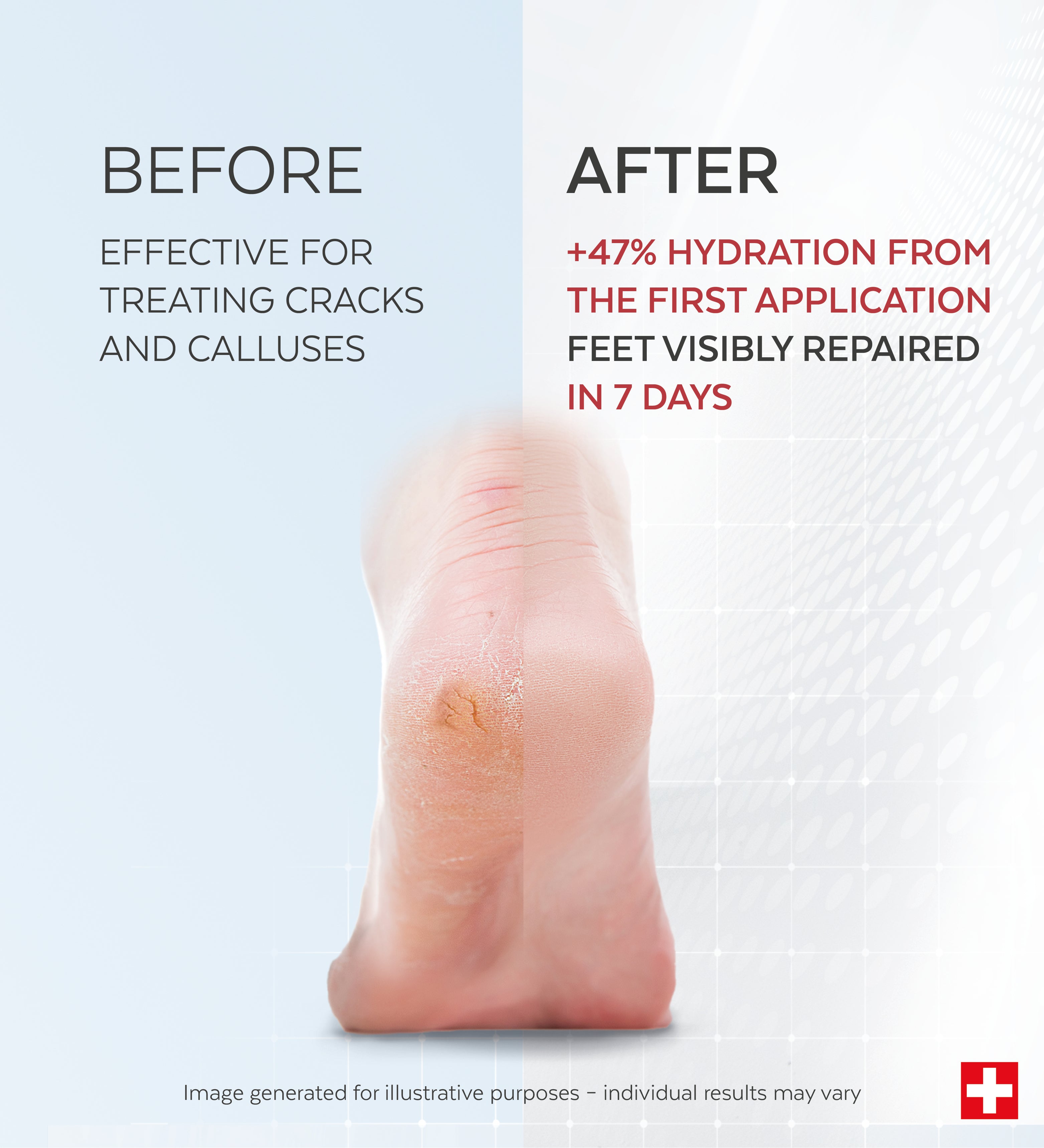Anti-calluses and cracks care - Foot Serum | Poderm® – PODERM®