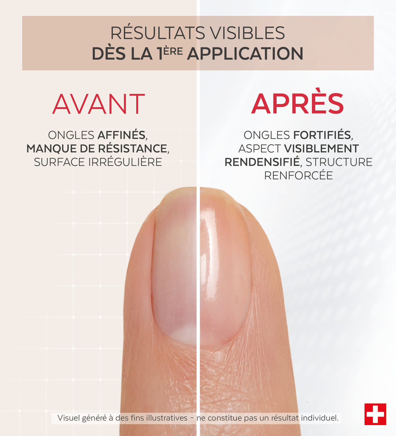Résultats avant après du vernis Nail Corrector redensifiant kératine Poderm dès la 1ère application