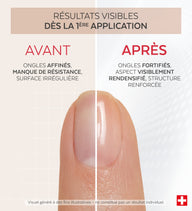Résultats avant après du vernis Nail Corrector redensifiant kératine Poderm dès la 1ère application