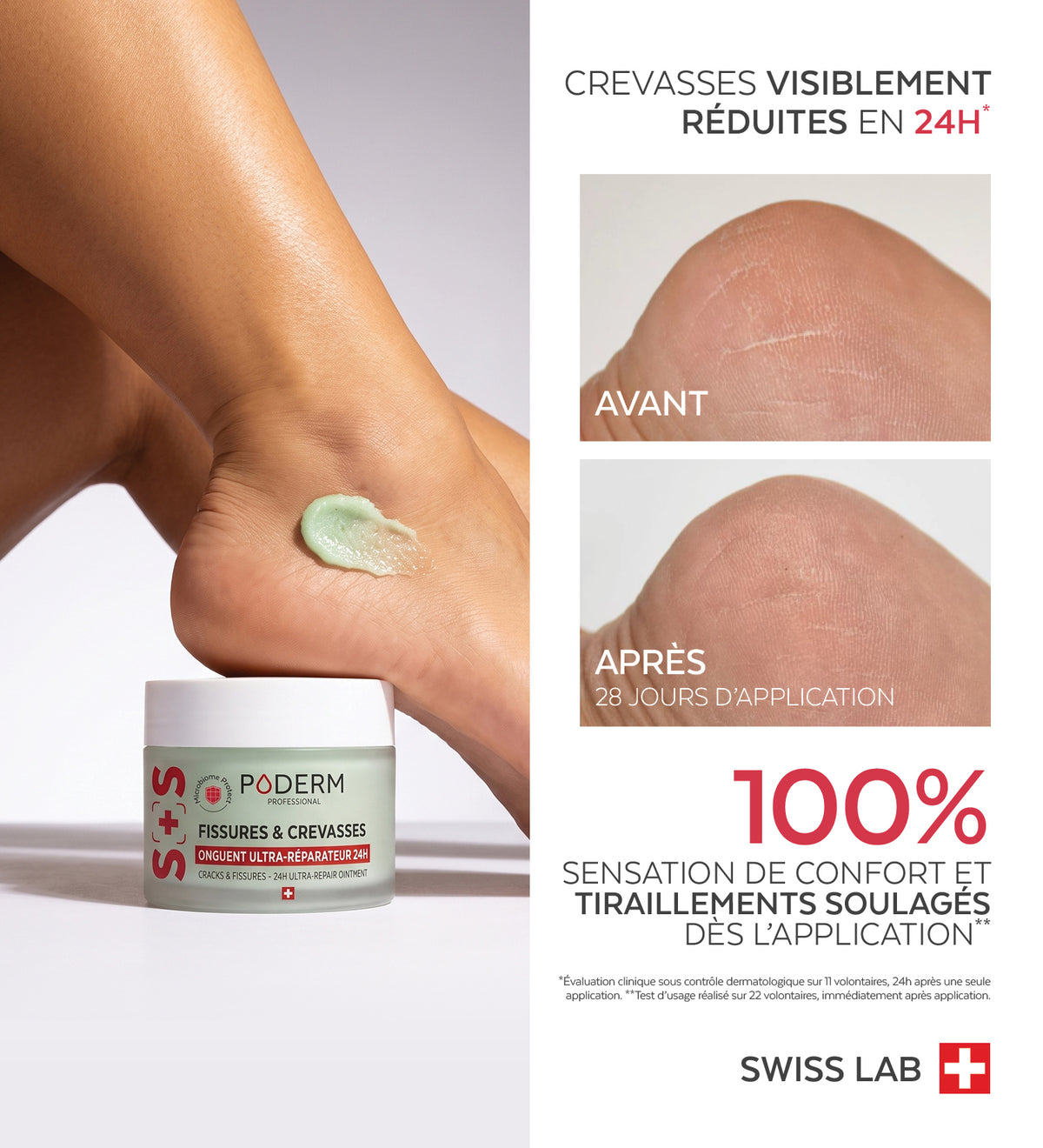 Duo SOS - Pieds secs & crevasses