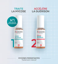 Duo express - Mycose des ongles