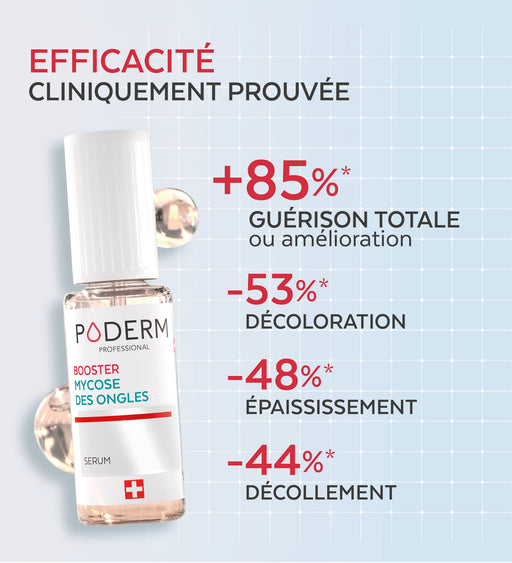 Duo express - Mycose des ongles