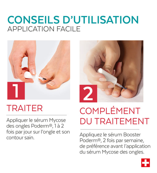 Duo express - Mycose des ongles