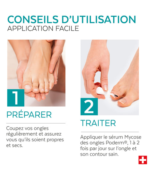 Mode d'emploi du sérum traitement mycose des ongles Poderm application 2 fois par jour