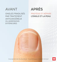 Sérum Ongles fragilisés Silicium