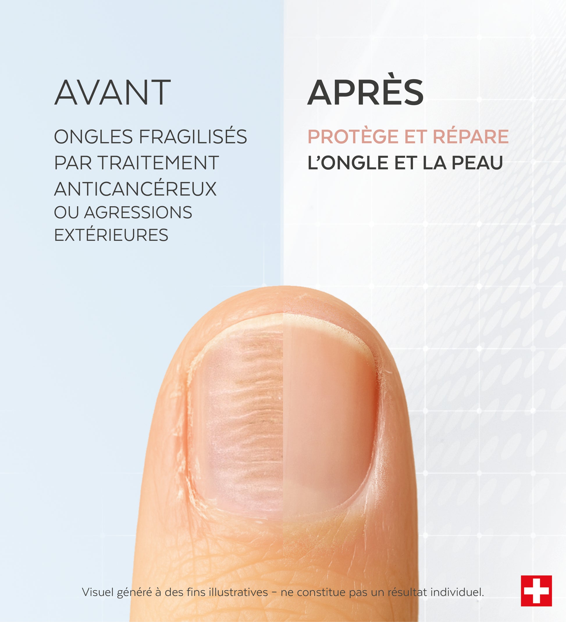 Sérum Ongles fragilisés Silicium