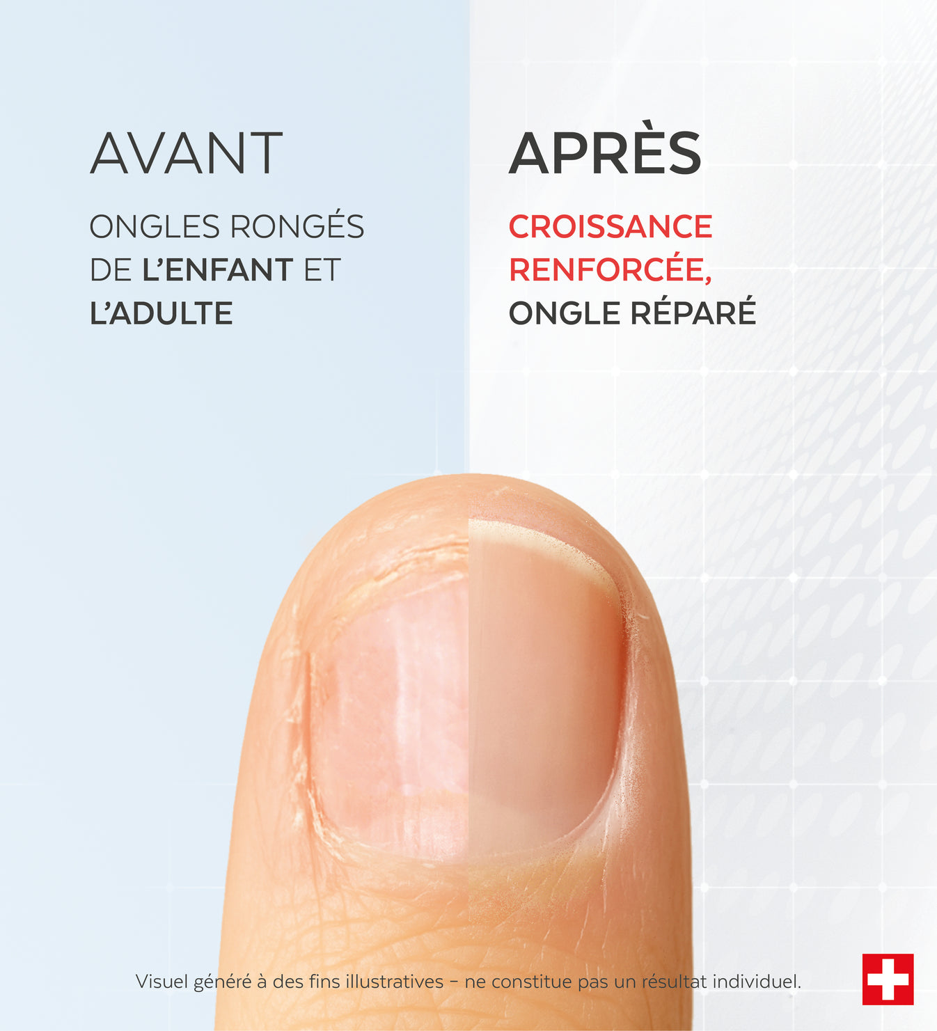 Sérum Ongles Rongés