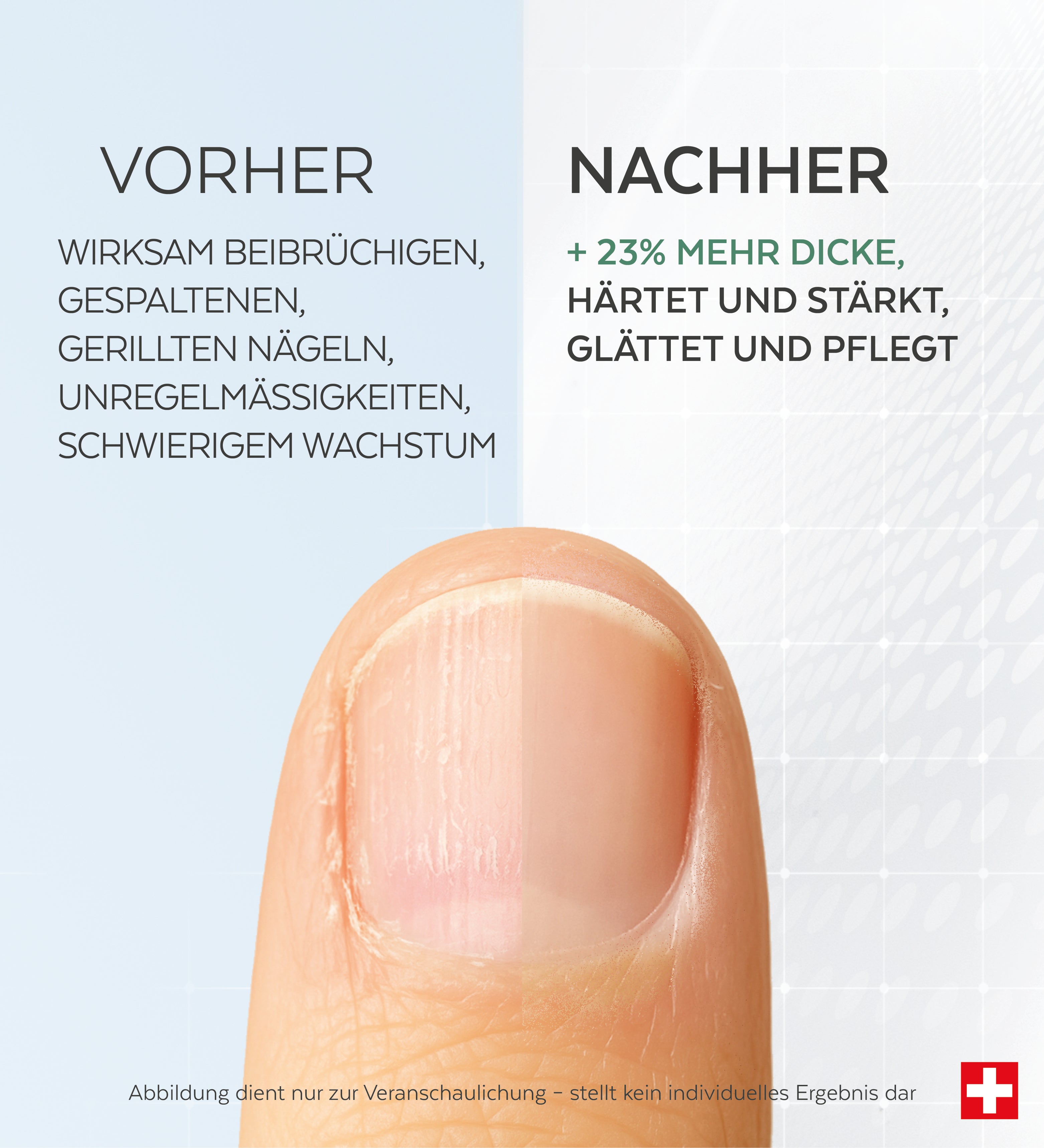 Nagelpflege Behandlung 30ml – Stärkt Brüchige Nägel, Mit Feile & Pinsel, Schnell Wirkend
