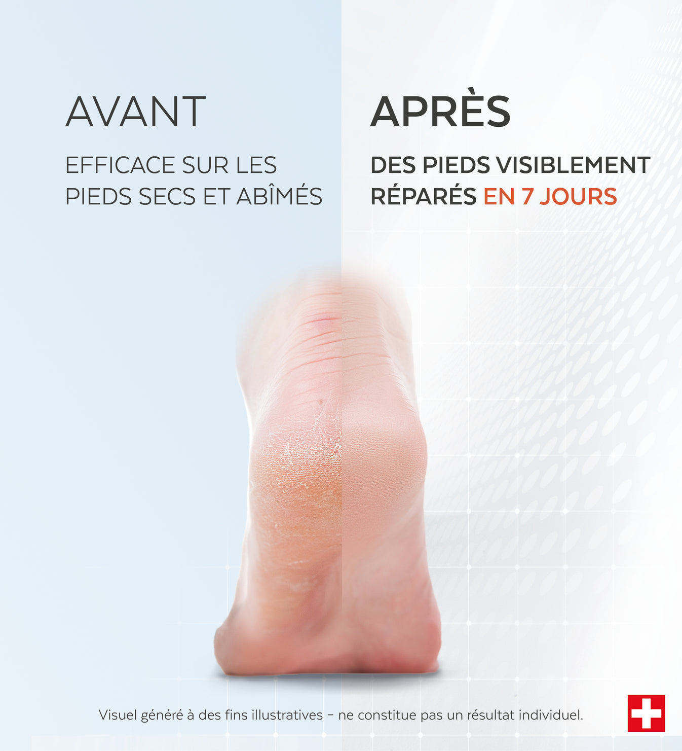 Sérum Pieds Très Secs et Abîmés