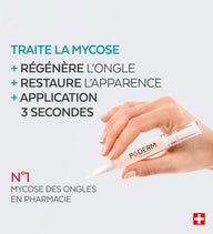 Bénéfices du stylo mycose des ongles Poderm 3 actions