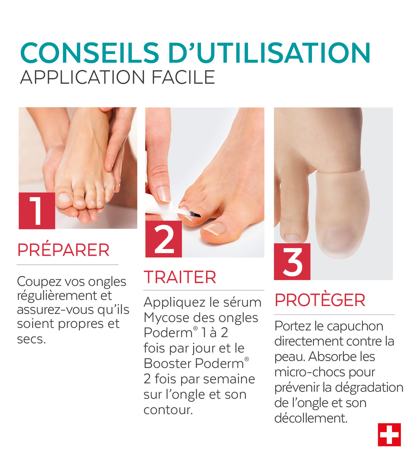 Trio Capuchon - Mycose des ongles