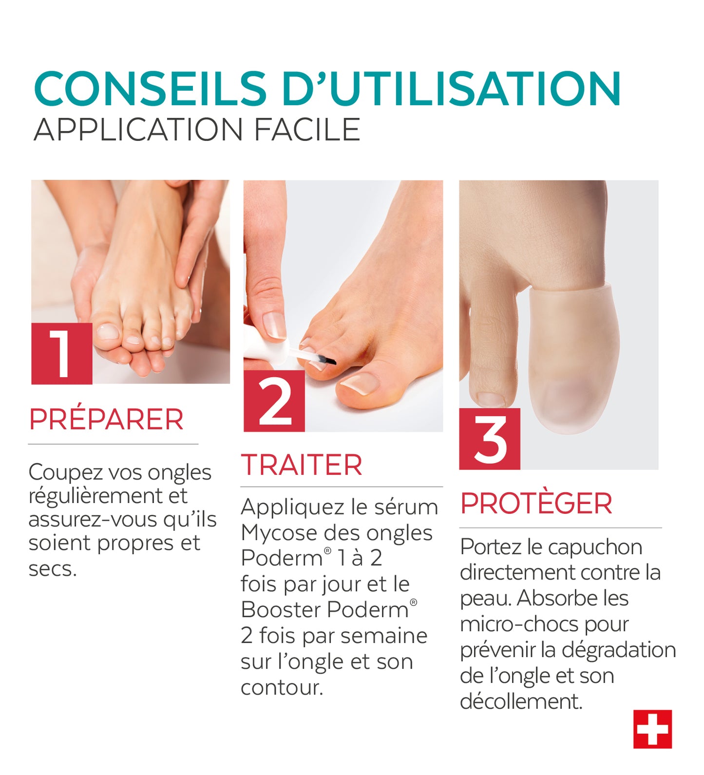 Trio Capuchon - Mycose des ongles