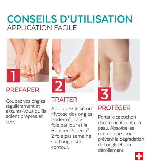 Trio Capuchon - Mycose des ongles