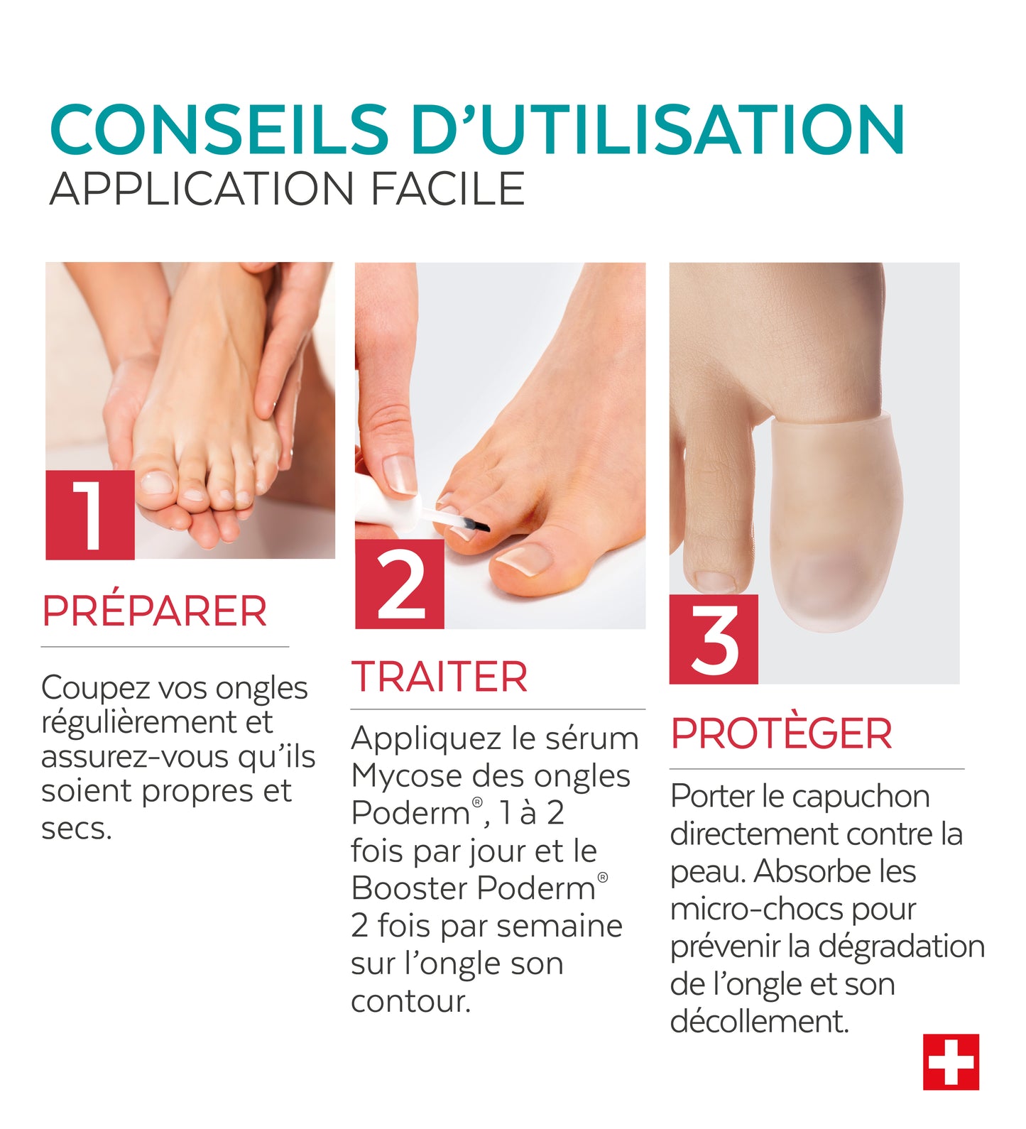 Application en 3 étapes du trio mycose Poderm préparer traiter protéger