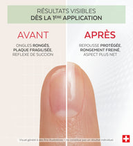 Résultats avant après du vernis Nail Corrector amer protéines de pois Poderm dès la 1ère application