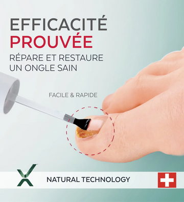 Pack Complet - Mycose des ongles