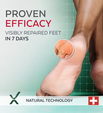 Irritated and dry feet Serum