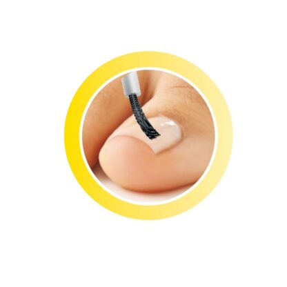 Behandlung von eingewachsenen Nägeln oder von Nagelpilz bei Kindern und Kleinkindern.