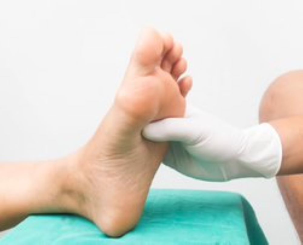 wen man wegen einer Hornhautschwiele an der Fußsohle aufsuchen sollte