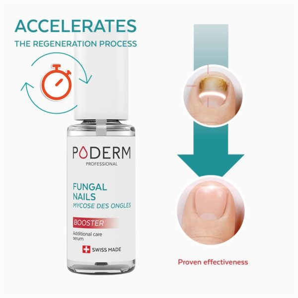 nail fungus fast and effective treatment poderm
